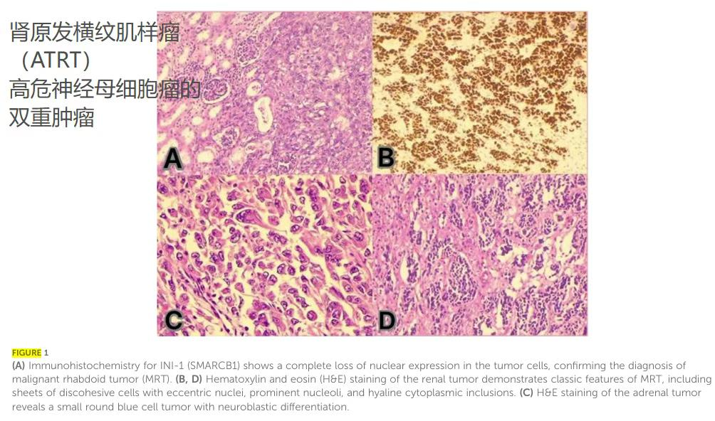 1772158110152780.png 640 (11).png